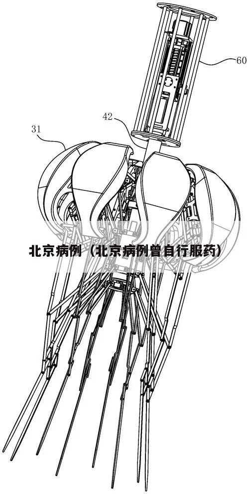 北京病例(北京病例曾自行服药)